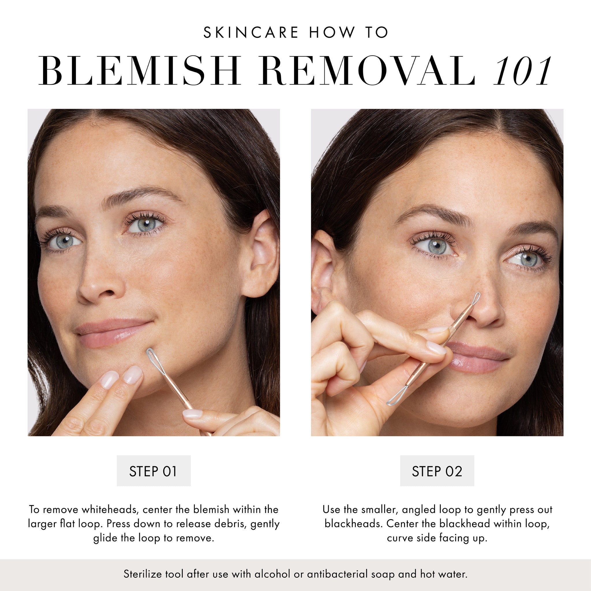 Rose Gold Whitehead and Blackhead Remover